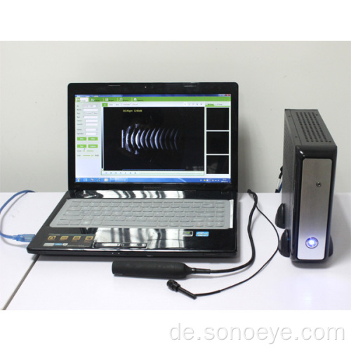 Ophthalmic Scannerbox unterstützen Labtop und PC